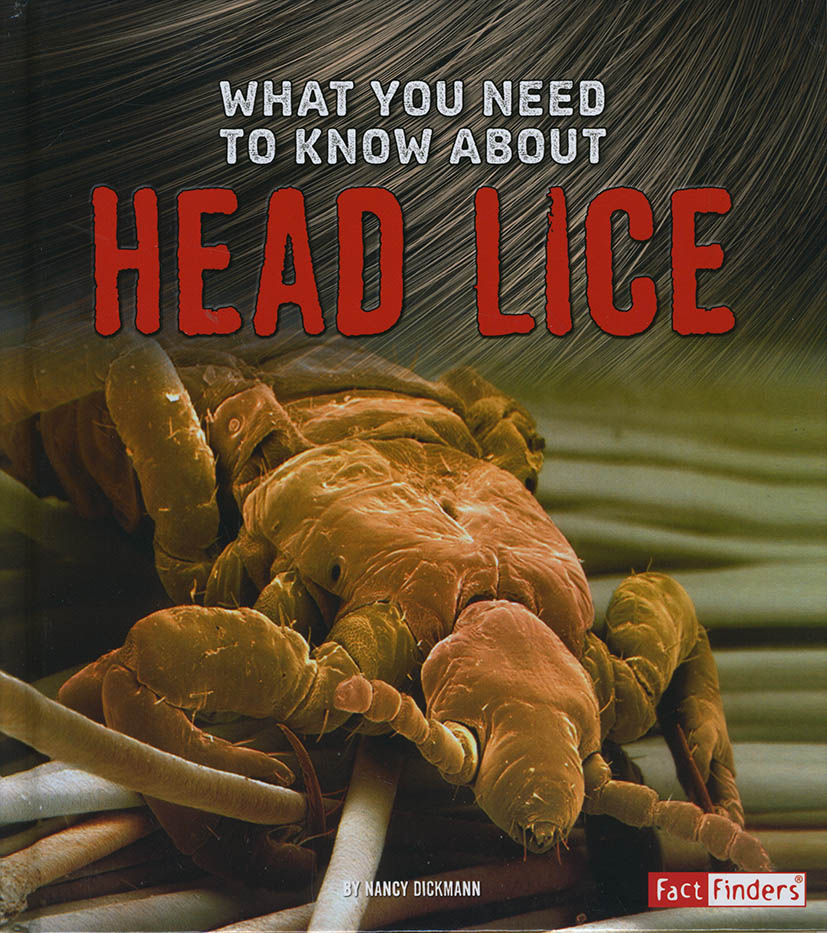 What You Need To Know About Head Lice Good Reading